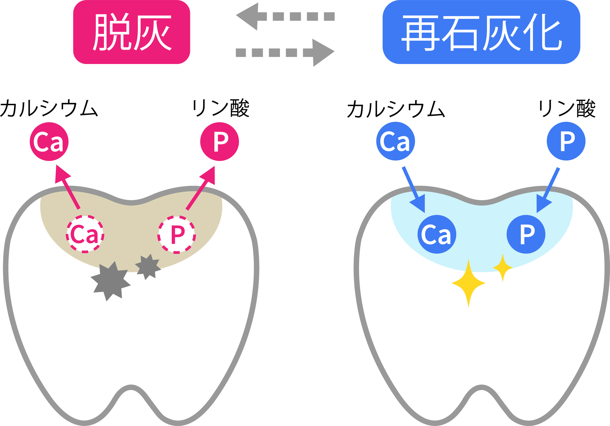 港南台パーク歯科クリニック｜院長ブログ｜虫歯予防にフッ素塗布をおすすめします｜再石灰化と脱灰の図