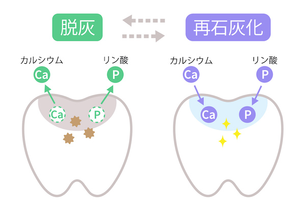 mi ペースト 虫歯 に なる