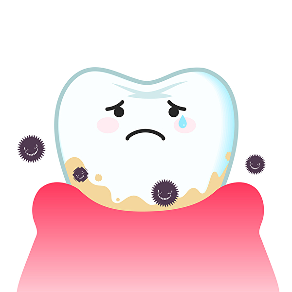 港南台パーク歯科クリニック｜ブログ｜子どもの歯肉炎の種類と原因は？歯肉炎のチェック方法も解説｜歯肉炎の画像