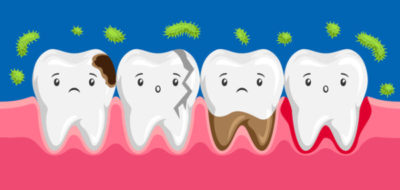 港南台パーク歯科クリニック｜歯科衛生士ブログ｜バクテリアセラピーについて｜細菌のために虫歯や歯周病のイラスト