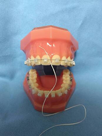 港南台パーク歯科クリニック｜ブログ｜ブラケットによる矯正治療中のセルフケアの方法についてご紹介｜ブラケットのフロスの画像1