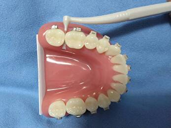 港南台パーク歯科クリニック｜ブログ｜ブラケットによる矯正治療中のセルフケアの方法についてご紹介｜ブラケットの歯間ブラシの画像2