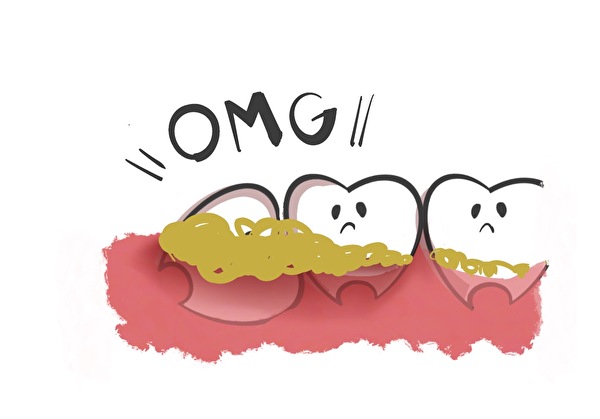 港南台パーク歯科クリニック｜ブログ｜知っていれば怖くない！親知らずの抜歯｜親知らずの歯周病