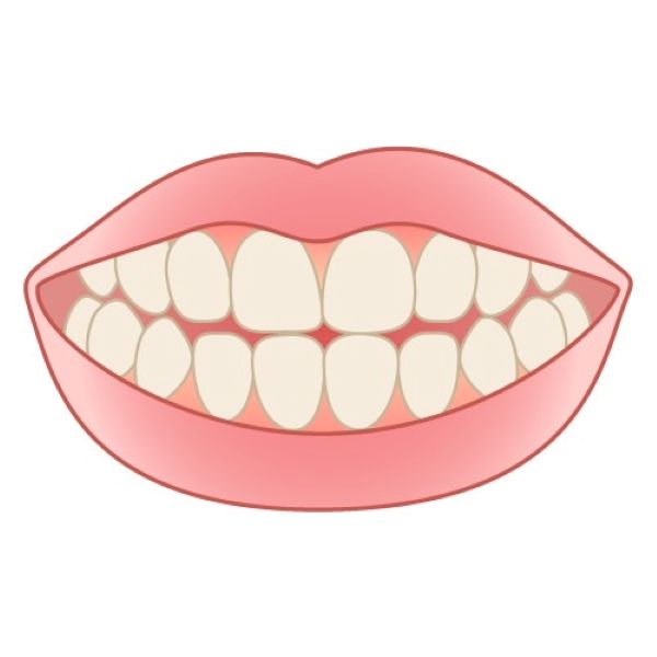 健康な歯のイメージ|歯が抜けた状態、放置しても大丈夫?|港南台の歯医者 港南台パーク歯科クリニック